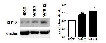 Western blotting을 통한 정상 세포주 HRCE와 ADPKD 환자 세포주 WT9-7, WT9-12의 KLF12 유전자의 단백질 발현량 검증