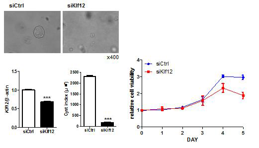 KLF12의 발현 감소 후, 3D culture 상에서 낭포 형성 억제와 cell viability assay를 통한 세포 증식 억제 효과 확인