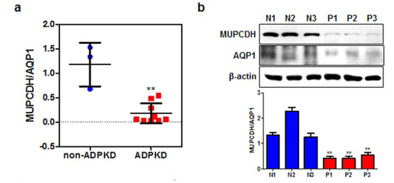 ADPKD 조직에서 저발현 되어있는 MUPCDH 유전자