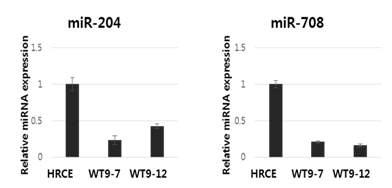 다낭신 환자 세포주에서 miR-204-5p 및 miR-708-5p의 발현 검증 (HRCE : 정상 세포주. WT9-7, WT9-12 : 다낭신 환자 세포주)