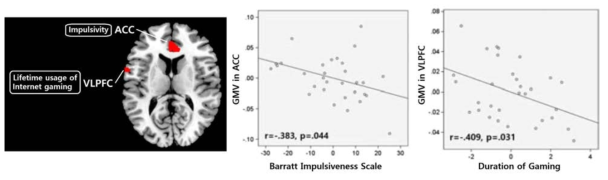ACC 와 충동성 점수(BIS) 와의 상관관계와 VLPFC 와 게임이용 기간과의 상관관계