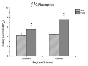 [C-11]Raclopride 의 binding potential 비교