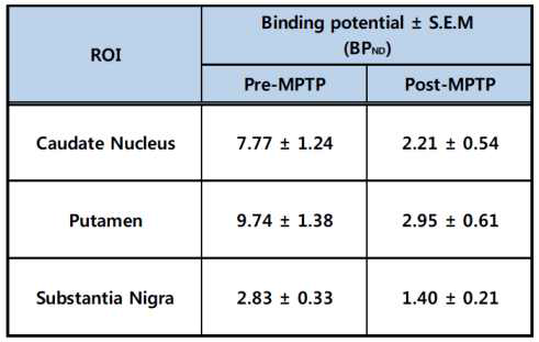 [18F]FP-CIT의 Binding Potential value