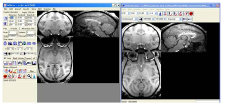 MRIcro와 MRIcron에서의 MRI image 작업 환경