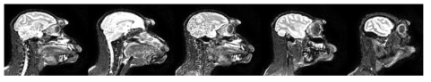 본 연구 수행으로 획득한 macaque monkey의 FLAIR image