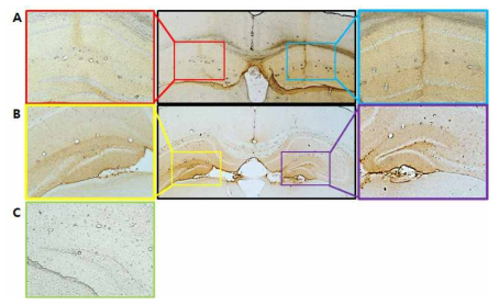 IHC of sgAPP-injected mouse hippocampus A and B : sgAPP 비삽입 렌티벡터가 주사된 5XFAD mouse hippocampus C : Non-injected 5XFAD mouse hippocampus