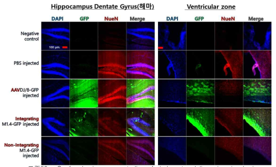 Confocal microscopy studies of viral vector delivery in mice brain