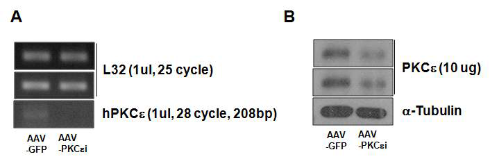 PKC epsilon siRNA AAV에 의한 PKC epsilon의 knockdown. A. 293 human cell에 PKC epsilon siRNA AAV를 infection 한 후 PKC epsiolon mRNA level의 감소를 RT-PCR을 통하여 확인함. B. Primary hepatocytes에 PKC epsilon siRNA AAV를 infection 한 후 PKC epsiolon protein level의 감소를 westernblot analysis를 통하여 확인함