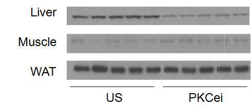 PKC epsilon siRNA AAV에 의한 knockdown 효과. 생쥐에 tail vein injection을 통하여 PKC epsilon siRNA AAV 및 control siRNA AAV (US)를 주입 후, 간, 근육, 백색 지방에서 PKC epsilon의 발현을 western blot analysis를 통하여 확인함