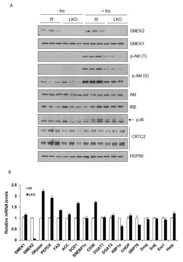 HFD feeding에 따른 PPP4R3b의 간특이적 결손 영향. 14주간 HFD feeding을 진행한 생쥐에서의 인슐린 신호전달 관련 단백질 활성 (A), 유전자 발현 변화(B) 를 분석함