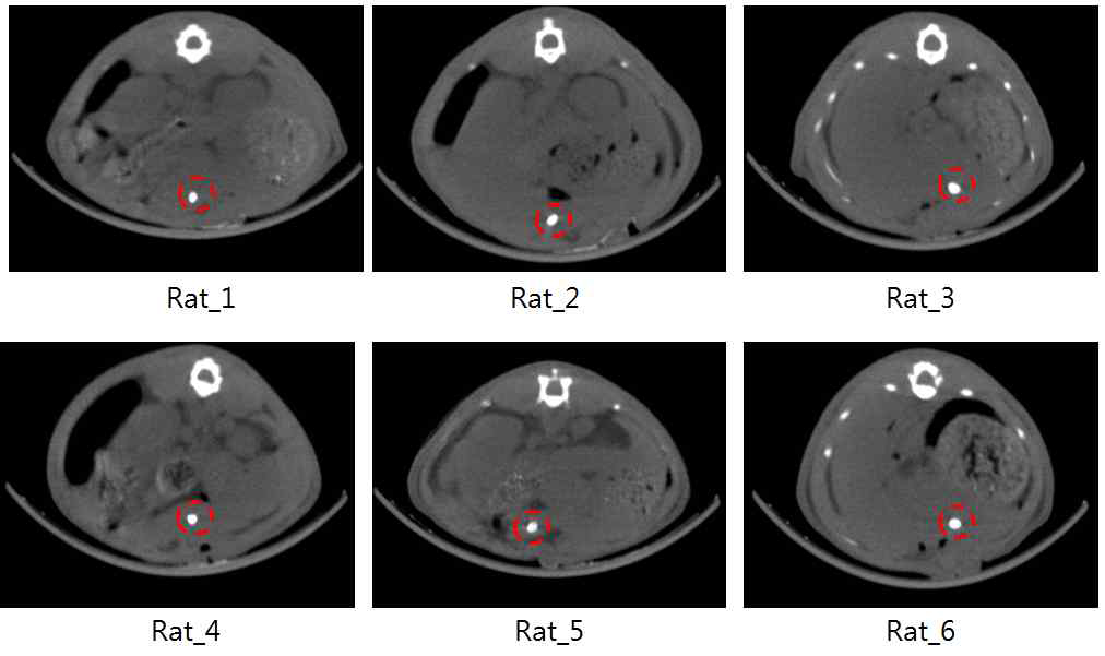 Rat 간에 주입된 고형화된 하이드로젤의 CT 영상 사진