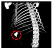 표지자 딜리버리 시스템을 활용한 물질주입 후 micro-CT 영상 3차원 구성 사진