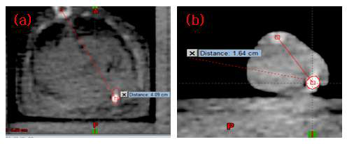 바이오 Pellet 형태 표지자 이동성 여부 spinal cord 와 거리 측정 (a) SD Rat, (b) Balb/c mouse