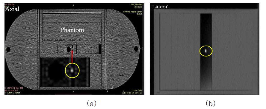 복부모사 팬텀에 위치한 표지자의 CT 영상 (a) Axial 방향 사진 과 (b) Lateral 방향 사진. 노란색 원 부분 내부에 표지가가 잘 식별됨