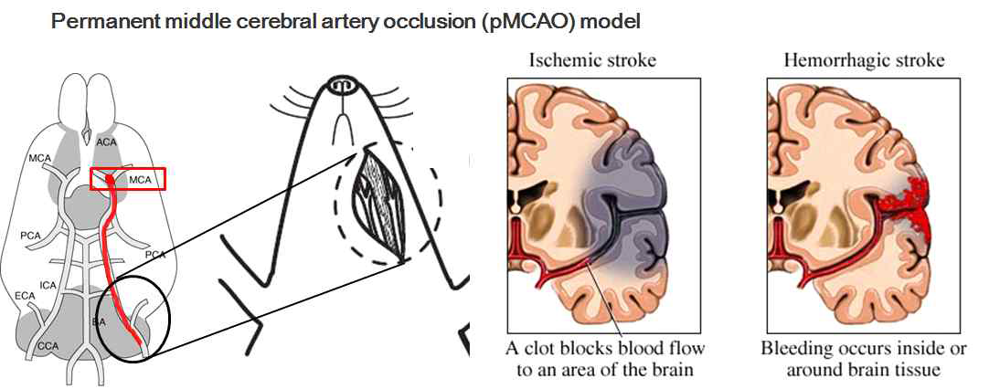 영구 중대뇌동맥폐쇄(pMCAo) 질환동물모델 제작. 중대뇌동맥폐쇄에 의한 뇌허혈손상 유발 방법 가운데 혈관내봉합사삽입술(intraluminal method)을 채택하고, 보다 광범위하고 일정한 뇌허혈을 유발하기 위해 poly-L-lysine coating method와 영구폐쇄방법을 시행하였다. 실험동물은 수컷 Sprague- Dawley계 흰쥐 동물로 반입 후 일주일 순화 과정을 거친 후 마취 유도 후, 왼쪽 목 피부를 절개, 안쪽으로 총경동맥, 외경동맥, 내경동맥을 박리 및 도출한 다음 외경동맥을 절단하고, 절단면을 통하여 외경동맥을 통해 삽입한 나일론 실이 내경동맥을 거쳐 중대뇌동맥 부위로 들어가도록 한 다음 중대뇌동맥을 폐쇄하고 수술부위를 봉합함