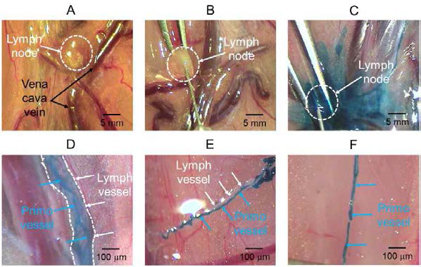 Images of lymph node in the vena cava of a rabbit (A) before and after (B) LPS injection to lymph node. Images of (C) staining lymph node after AB injection and (D) floating PV inside a LV. Images of (E) an isolating PV from LV and (F) an isolated PV. White dot circle lines indicate lymph node and white and sky color arrows indicate LV and PV, respectively