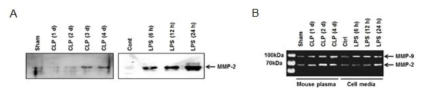 HUVEC 세포에서의 CLP 또는 LPS 자극에 의한 MMP-2 분비 측정 Western blot 결과 (A) zymography 결과 (B)