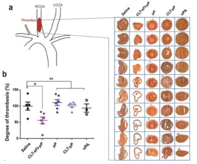 CLT-sFt-μP 나노케이지 및 다양한 대조군를 투여한 동맥 혈전증 동물 모델에서의 혈전 용해성 치료 효과 결과