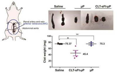 CLT-sFt-μP 나노케이지 및 다양한 대조군을 투여한 심부정맥혈전증 동물모델에서의 혈전 용해성 치료 효과 결과