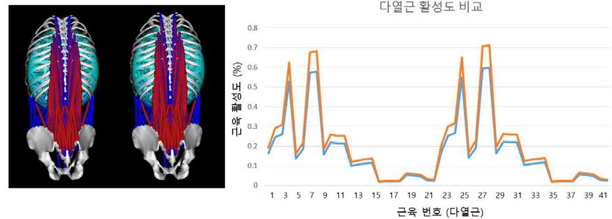 side-bridge의 기존자세(좌측, 그래프 파란색)와 변형된 자세 (우측, 그래프 주황색) 간 활성 근육 및 활성도 비교