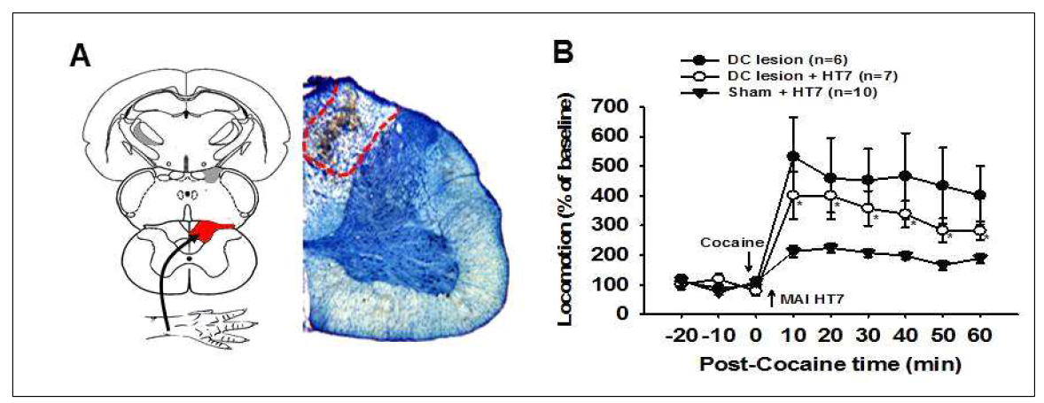 Blocking by DC lesions of HT7 effects on cocaine-induced locomotor activity in rats. A, B: Inhibitory effects of acupuncture at HT7 were blocked when surgical transection of dorsal column at C3 level was performed 8-10 days before test