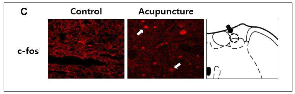 Cuneate Nucleus에서 신문혈 침술 자극 후 c-fos 활성도 시험