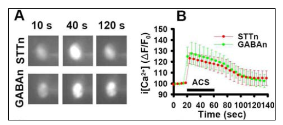 STTn (n=4), GABAn (n=4)에서 자극 전후 Ca2+ 변화. ACS=afferent conditioning stimulation (전기적 신경자극)