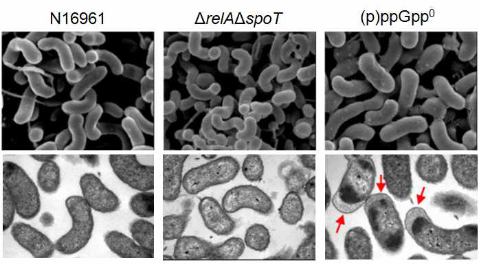 Wild type 콜레라 균주인 N16961 (왼쪽), (p)ppGpp를 축적하는 ΔrelAΔspoT mutant (가운데), (p)ppGpp 합성하지 못하는 (p)ppGpp0 mutant (오른쪽)의 전자 현미경 사진. 위 3개 및 아래 3개의 사진은 각각 SEM, TEM 사진임. 빨간색 화살표는 periplasmic space의 간격이 벌어진 특이한 세포 구조를 보여줌