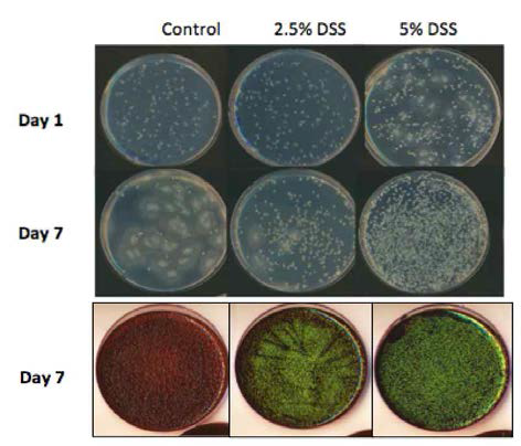 DSS 처리 과정 중에 발생하는 마우스 분변 미생물의 분포 변화. 위 2개의 plate는 LB plate이며, 가장 아래 plate는 EMB plate를 보여줌. LB plate에서 colony 주변으로 퍼져있는 zone을 만드는 균주는 Proteus sp.로 동정되었으며, EMB plate에서 metalic green sheen 형태의 colony를 형성하는 균주는 대장균임. Proteus sp.도 대장균과 함께 Enterobacteriaceae에 포함되는 종으로서, 이는 DSS 처리 과정 중에 Enterobacteriaceae가 증가하지만, Enterobacteriaceae에 포함되는 종들 가운데서도, 분포 변화의 양상이 시간에 따른 차이를 보임을 보여줌