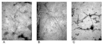 CTX phage의 전자 현미경 사진. (A): CTX-1, (B): CTX-2, (C) CTX-O139