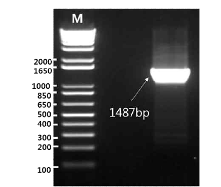 RT-PCR of Zika virus Envelope gene