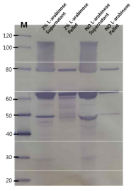 Westernblot analysis of the recombinat Zika envelope protein