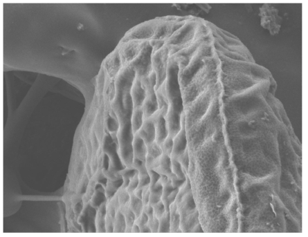 Plumatella sp. 휴면아의 봉합선 모습