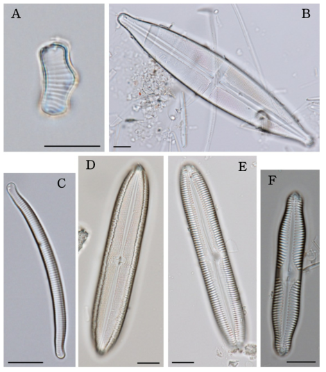 주요 출현종. 돌말류 A. Eunotia exigua, B. Stauroneis gracilis. C. Eunotia elegans, D. Neidium bisulcatum var. subampliatum, E. Pinnularia viridiformis, F. Pinnularia microstauron var. nonfasciata (Scale bar=10㎛)