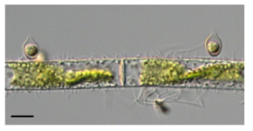 Chrysopyxis inaequalis (Scale bar=10 ㎛)