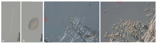 좌: Pseudoperonospora urticae KZITFG0000000017 (KUS-F24488), 중: Bremia sp. 1 ex Crepidiastrum denticulatum KZITFG0000000932 (KUS-F21509), 우: Bremia sp. 2 ex Ixeris polycephala KZITFG0000000933 (KUS-F18854)