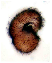 Colpoda variablis Foissner, 1980