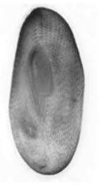 Frontonia depressa. Ventral view of a protargol-imprengated specimen