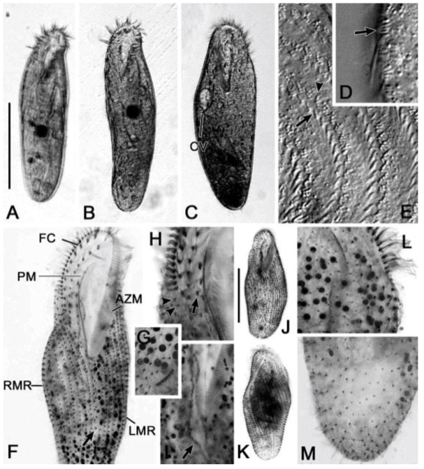 Hemicycliostyla fanzi live and protargol impregnated specimens. Scale bars: 100 μm