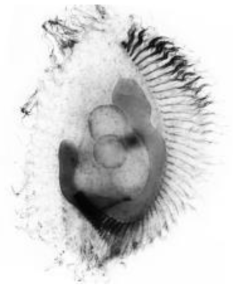 Phacodinium metchnicoffi. Ventral view of a protargol-impregnated specimen