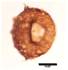 Centropyxis delicatula Penard, 1902. Scale bar = 50 μm