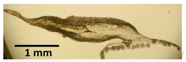 Photomicrograph of the habitus of Pseudothoracocotyla ovalis (Tripathi, 1956) Yamaguti, 1963