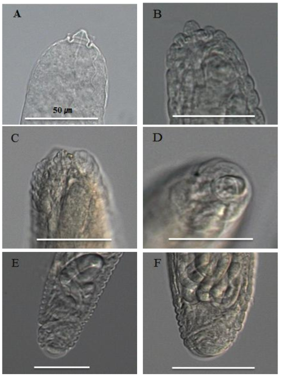 Parasitic female of Parasitylenchus cyrtogenii n. sp., light micrographs. (A)∼(D) Head; (E),(F) Tail
