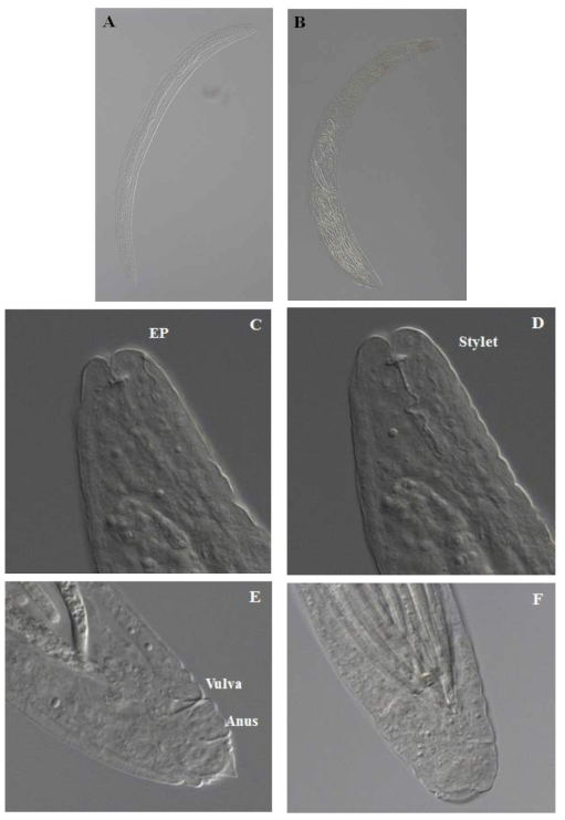 Parasitylenchus oscavus n. sp., light micrographs. (A) Young parasitic female; (B) Mature parasitic female; (C),(D) Head; (E),(F) Tail