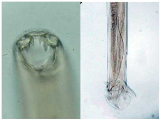 Ancylostoma kusimaense; head and posterior extremity of male worm