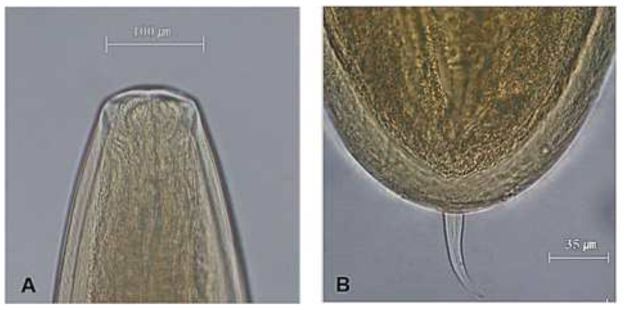 Hexamermis albicans, Post-parasitic juveniles. (A) Head; (B) Tail