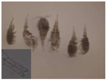 Caudal rami of Heterocyclopina uljinensis sp. nov