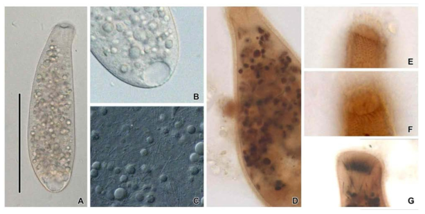Protospathidium n. sp. from live (A-C), after protargol impregnation (D-G). A. Body shaped. B, Contractile vacuole. C. Extrusome of body region. D. Macronucleus. E, F. Right and Left side somatic kineties pattern. G. Extrusome of oral region. Scale bar in A = 100 μm