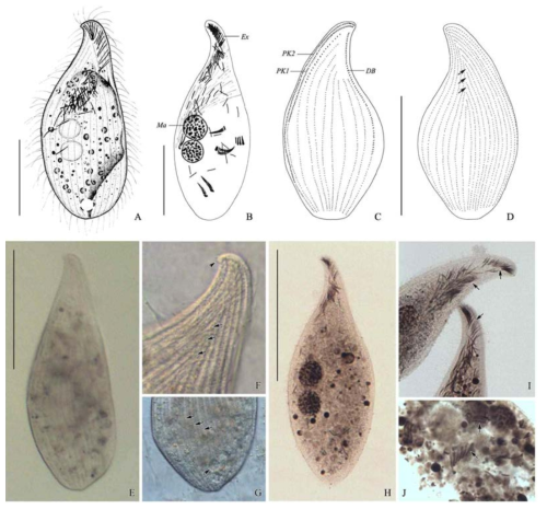 Morphology of Amphileptus litonotiformis from live (A, E-G) and protargol-impregnated (B-D, H-J) specimens. A, E, Appearance of a typical live individual; B, H, Nuclei, extrusomes, and nematodesmata with protargol-impregnation. C, D, Ciliary pattern after protargol-impregnation, left (C) and right (D) sides; F, Right view of live specimen, beak-like anterior region (arrowhead) and suture (arrows); G, Posterior region, contractile vacuole (arrowhead) and somatic kineties (arrows); I, Anterior region, extrusomes (arrows); J, Inside body, membranelles of feeding hypotrichs (arrows). Scale bars: 100 μm