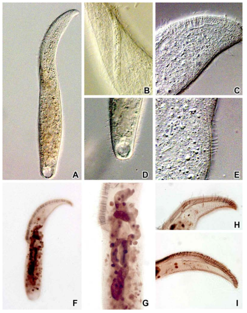 Arcuospathidium cultriforme scalpriforme from live (A-E), after protargol impregnation (F-I). A, F. Body shaped. B. Oral bulge pattern. C. Contractile vacuole. D. Extrusomes. E. Dorsal brush shaped. G. Macronucleus. H. Circumoral kinety. I. Dorsal brush rows